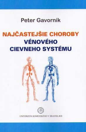 Najčastejšie choroby vénového systému Najčastejšie choroby vénového systému