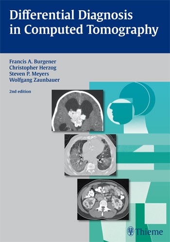 Differential Diagnosis in Computed Tomography Differential Diagnosis in Computed Tomography
