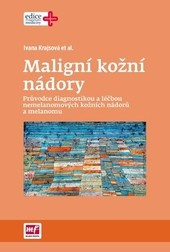 Maligní kožní nádory Maligní kožní nádory
