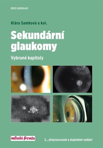 Sekundární glaukomy, 2.vydání