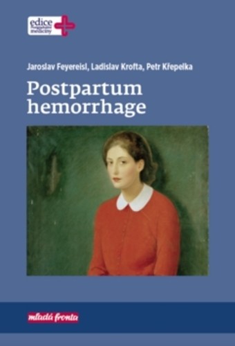 Postpartum hemorrhage Postpartum hemorrhage