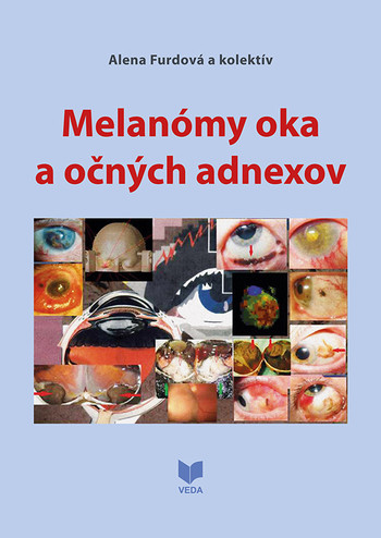 MELANÓMY OKA A OČNÝCH ADNEXOV MELANÓMY OKA A OČNÝCH ADNEXOV