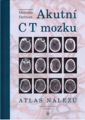 Akutní CT mozku Akutní CT mozku
