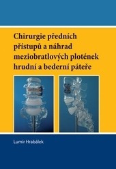 Chirurgie předních přístupů a náhrad meziobratlových plotének hrudní a bederní páteře Chirurgie předních přístupů a náhrad meziobratlových plotének hrudní a bederní páteře