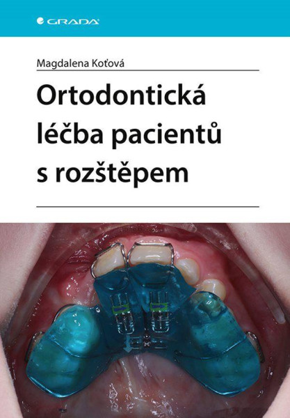 Ortodontická léčba pacientů s rozštěpem Ortodontická léčba pacientů s rozštěpem