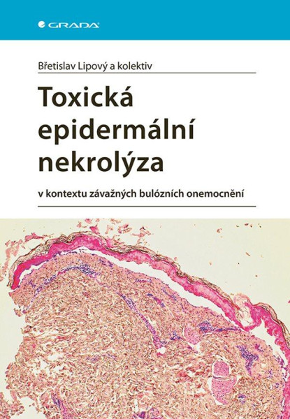 Toxická epidermální nekrolýza v kontextu závažných bulózních onemocnění Toxická epidermální nekrolýza v kontextu závažných bulózních onemocnění