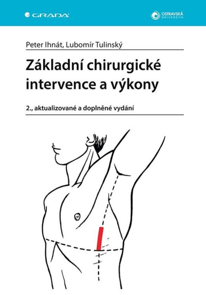 Základní chirurgické intervence a výkony Základní chirurgické intervence a výkony