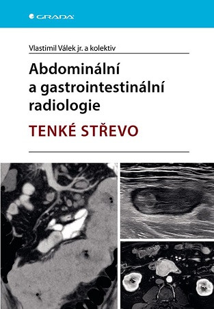 Abdominální a gastrointestinální radiologie Abdominální a gastrointestinální radiologie