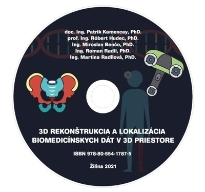 CD - 3D rekonštrukcia a lokalizácia biomedicínskych dát v 3D priestore CD - 3D rekonštrukcia a lokalizácia biomedicínskych dát v 3D priestore