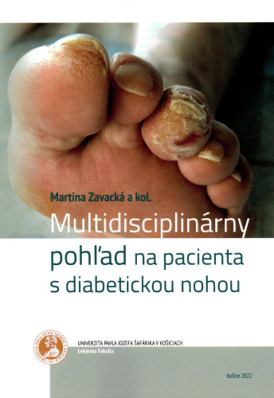 Multidisciplinárny pohľad na pacienta s diabetickou nohou Multidisciplinárny pohľad na pacienta s diabetickou nohou