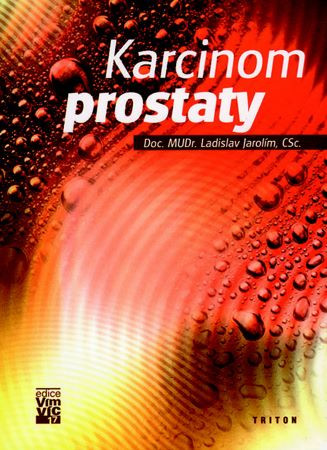 Karcinom prostaty Karcinom prostaty