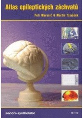 Atlas epileptických záchvatů +cd priručka Atlas epileptických záchvatů +cd priručka