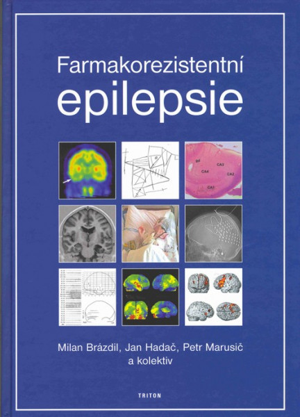 Farmakorezistentní epilepsie