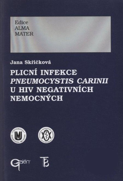 Plicní infekce Pneumocystis carinii u HIV negativních nemocných Plicní infekce Pneumocystis carinii u HIV negativních nemocných