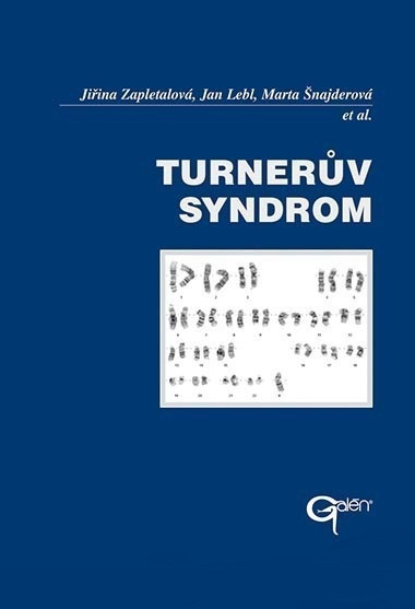 Turnerův syndrom Turnerův syndrom