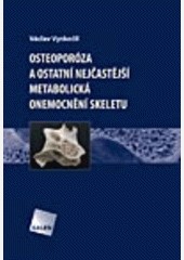 Osteoporóza a ostatní nejčastější metabolická onemocnění skeletu