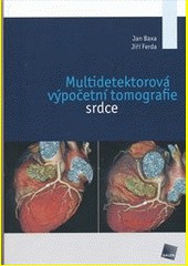 Multidetektorová výpočetní tomografie srdce Multidetektorová výpočetní tomografie srdce
