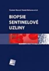 Biopsie sentinelové uzliny Biopsie sentinelové uzliny