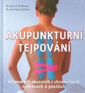 Akupunkturní tejpování Akupunkturní tejpování