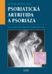 Psoriatická artritida a psoriáza