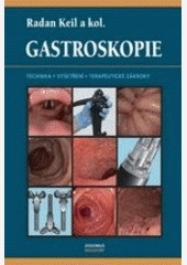 Gastroskopie Gastroskopie