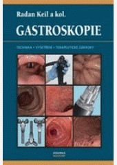 Gastroskopie