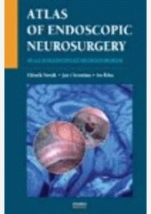 Atlas endoskopické neurochirurgie Atlas endoskopické neurochirurgie
