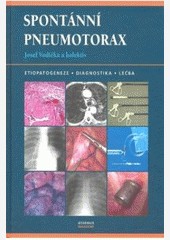Spontánní pneumotorax Spontánní pneumotorax