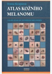 Atlas kožního melanomu Atlas kožního melanomu