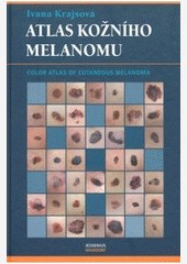 Atlas kožního melanomu