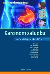 Karcinom žaludku Karcinom žaludku