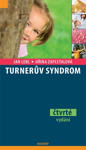 Turnerův syndrom Turnerův syndrom