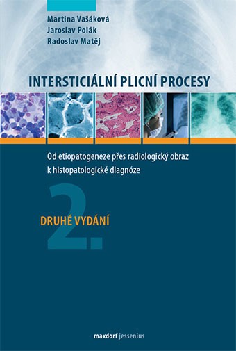 Intersticiální plicní procesy, 2.vydání Intersticiální plicní procesy, 2.vydání