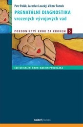 Prenatální diagnostika vrozených vývojových vad Prenatální diagnostika vrozených vývojových vad