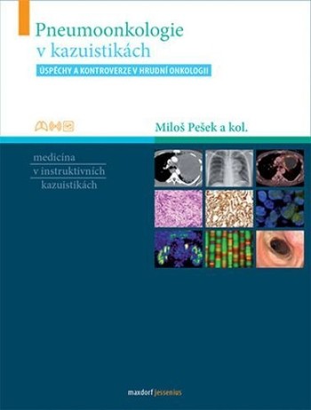 Pneumoonkologie v kazuistikách Pneumoonkologie v kazuistikách