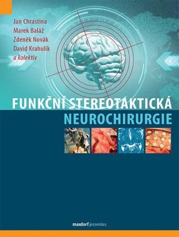 Funkční stereotaktická neurochirurgie Funkční stereotaktická neurochirurgie