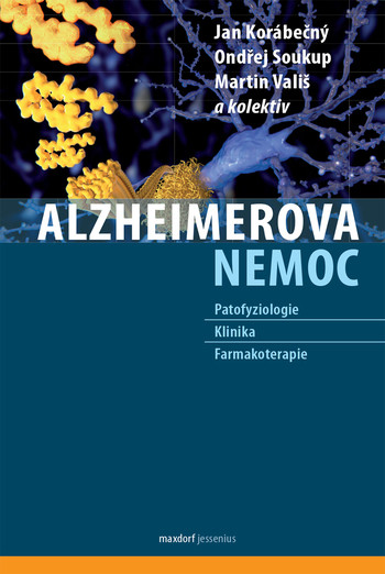 Alzheimerova nemoc Alzheimerova nemoc