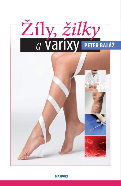 Žíly, žilky a varixy Žíly, žilky a varixy