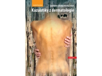 Kazuistiky z dermatologie Kazuistiky z dermatologie