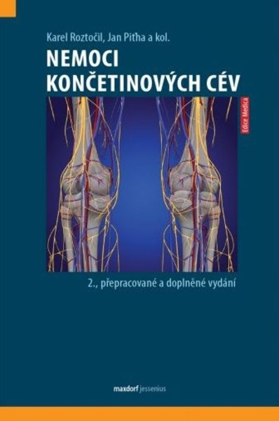 Nemoci končetinových cév Nemoci končetinových cév