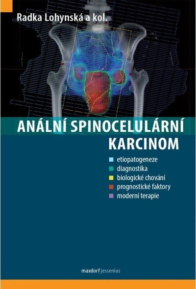 Anální spinocelulární karcinom Anální spinocelulární karcinom