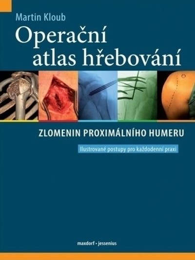 Operační atlas hřebování zlomenin proximálního femuru