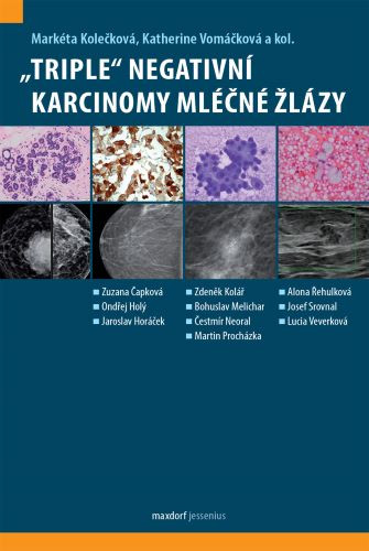 ,,Triple“ negativní karcinomy mléčné žlázy ,,Triple“ negativní karcinomy mléčné žlázy