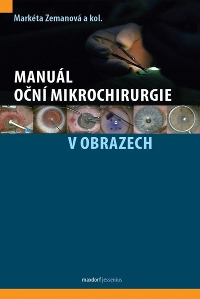 Manuál oční mikrochirurgie v obrazech Manuál oční mikrochirurgie v obrazech