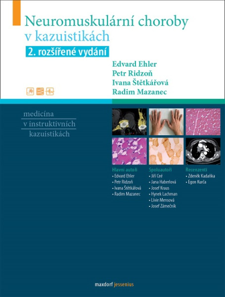 Neuromuskulární choroby v kazuistikách, 2. rozšířené vydání Neuromuskulární choroby v kazuistikách, 2. rozšířené vydání