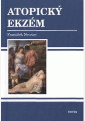 Atopický ekzém Atopický ekzém