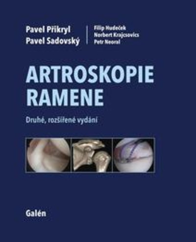 Artroskopie ramene - Druhé, rozšířené vydání