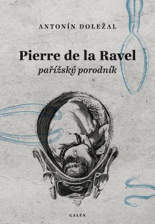 Pierre de la Ravel, pařížský porodník