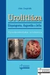 Urolitiáza. Etiopatogenéza, diagnostika a liečba