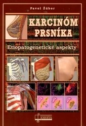 Karcinóm prsníka Karcinóm prsníka